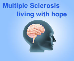 Multiple Sclerosis. MS, Extreme tiredness, Dizzy, Dizziness, Weak, Fog